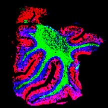 New technique expands tissues so hundreds of biomolecules can be seen inside cells