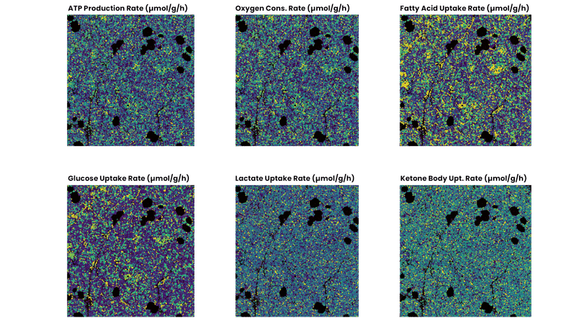 Single-cell metabolism from FFPE tissue: precise insight ...